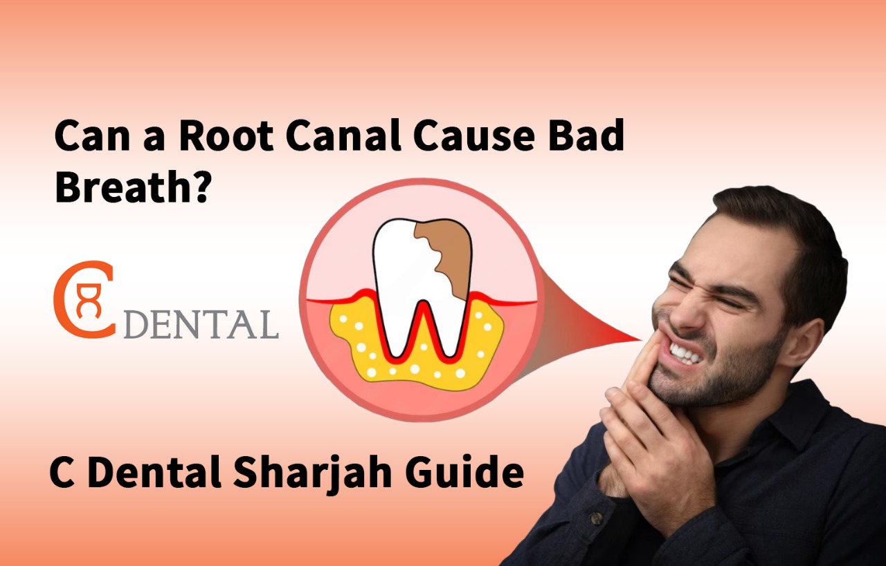 Root Canal