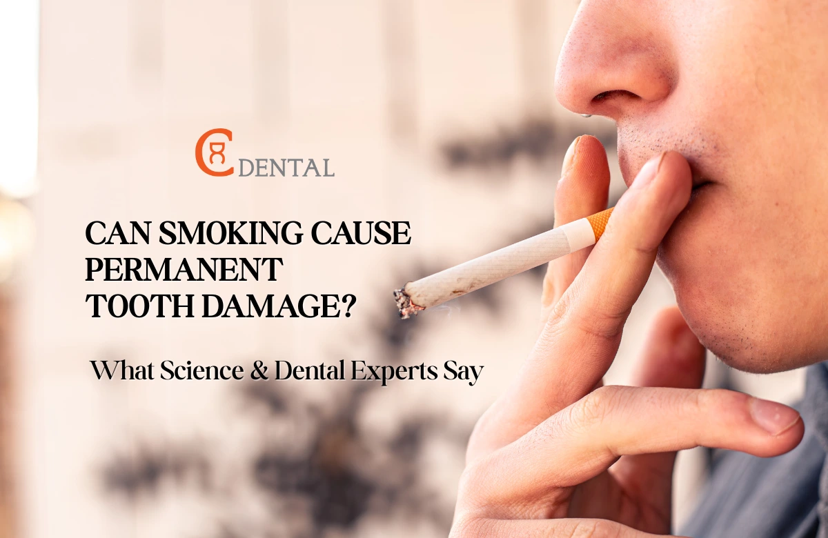 Can Smoking Cause Permanent Tooth Damage? &mdash; What Science & Dental Experts Say