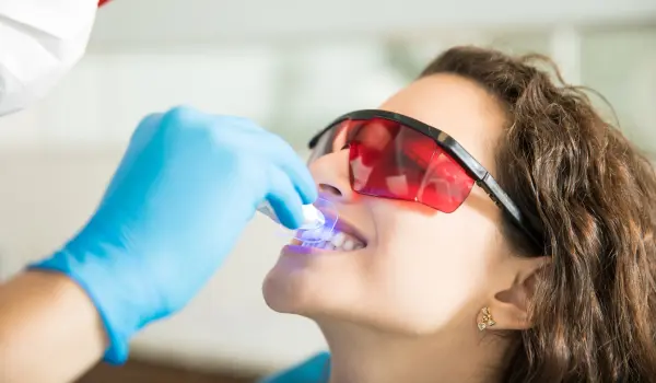 Cosmetic teeth whitening treatment in Sharjah