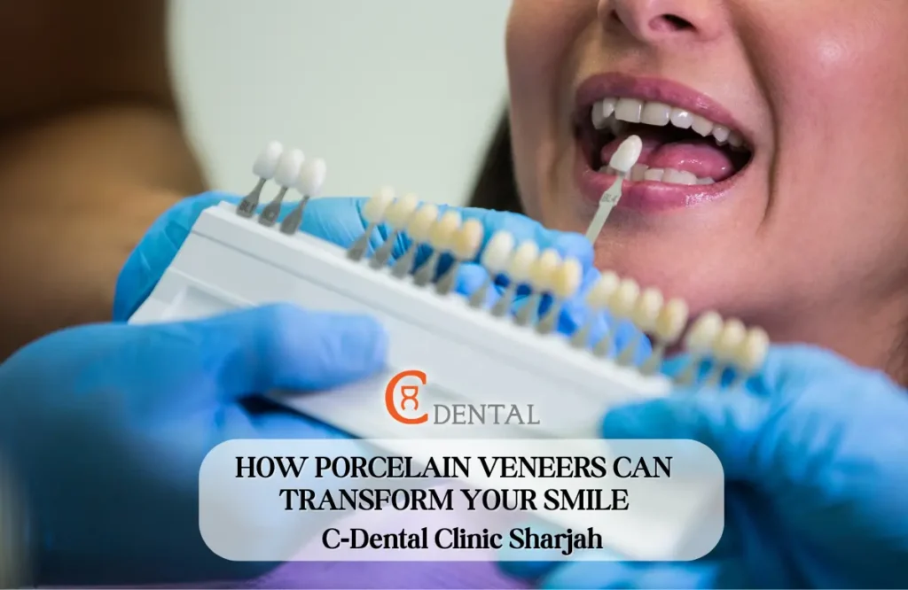 Smile makeover with porcelain veneers at C‑Dental Clinic in Sharjah