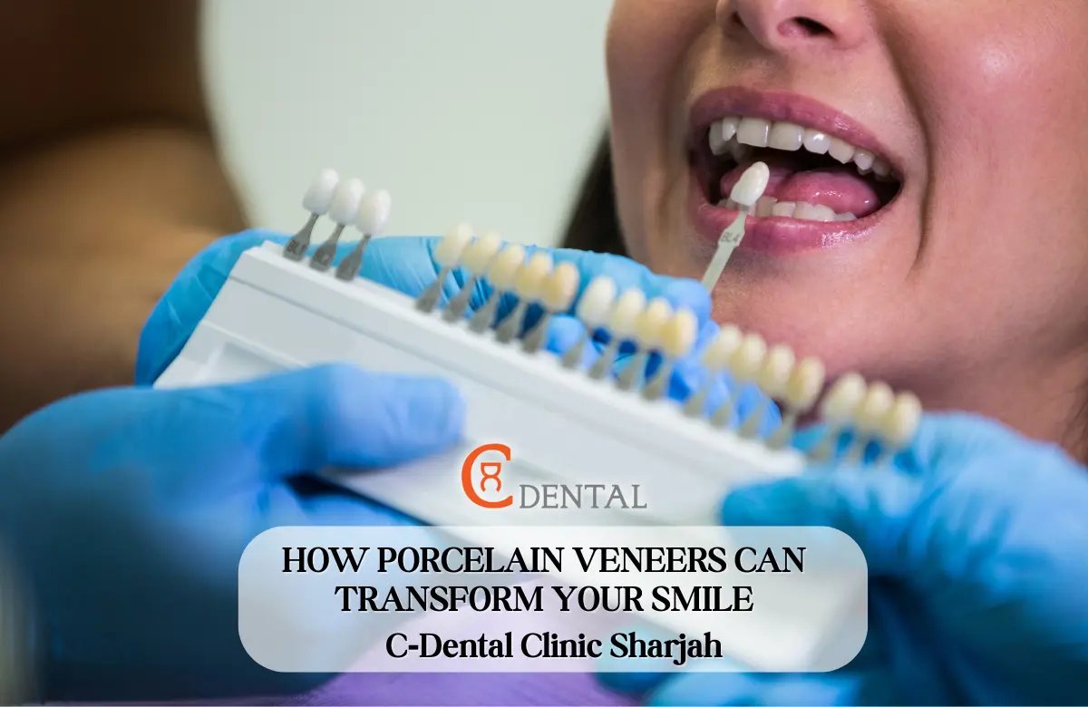 Smile makeover with porcelain veneers at C‑Dental Clinic in Sharjah