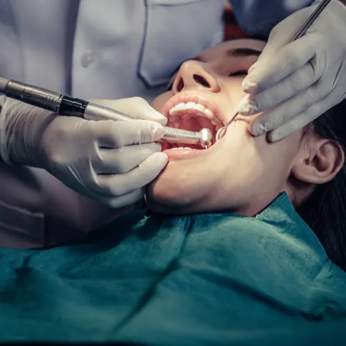 Expert Root Canal Care at C Dental Clinic Sharjah