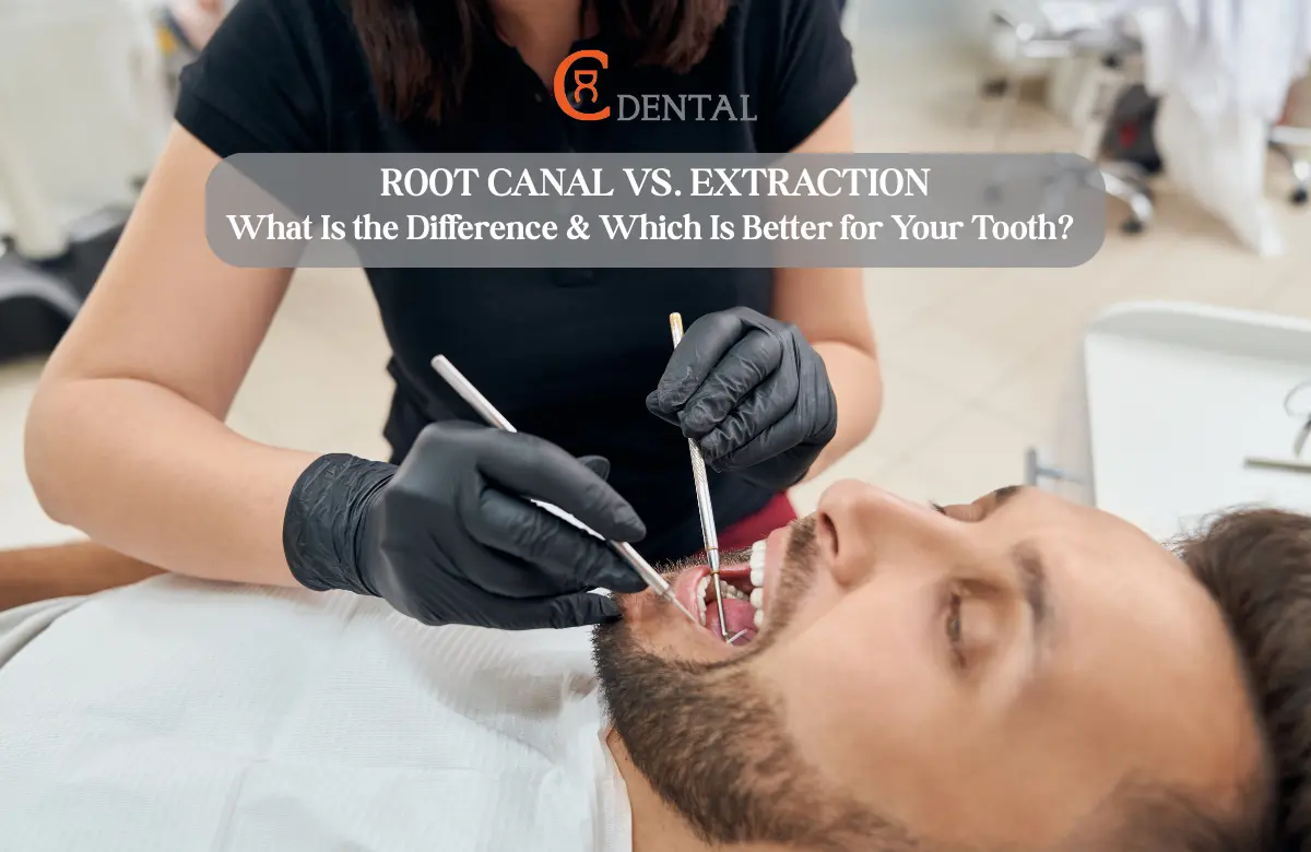 Root Canal vs. Extraction: What Is the Difference & Which Is Better for Your Teeth?