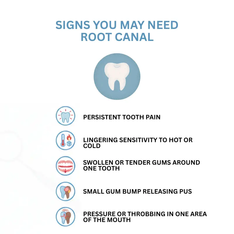 Signs You May Need a Root Canal