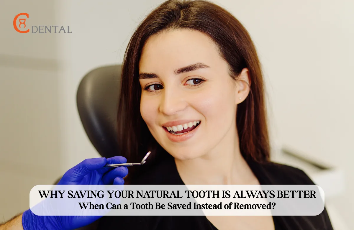 Why Saving Your Natural Tooth Is Always Better: When Can a Tooth Be Saved Instead of Removed?