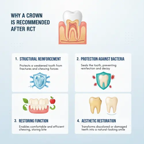Why a Crown Is Recommended After RCT