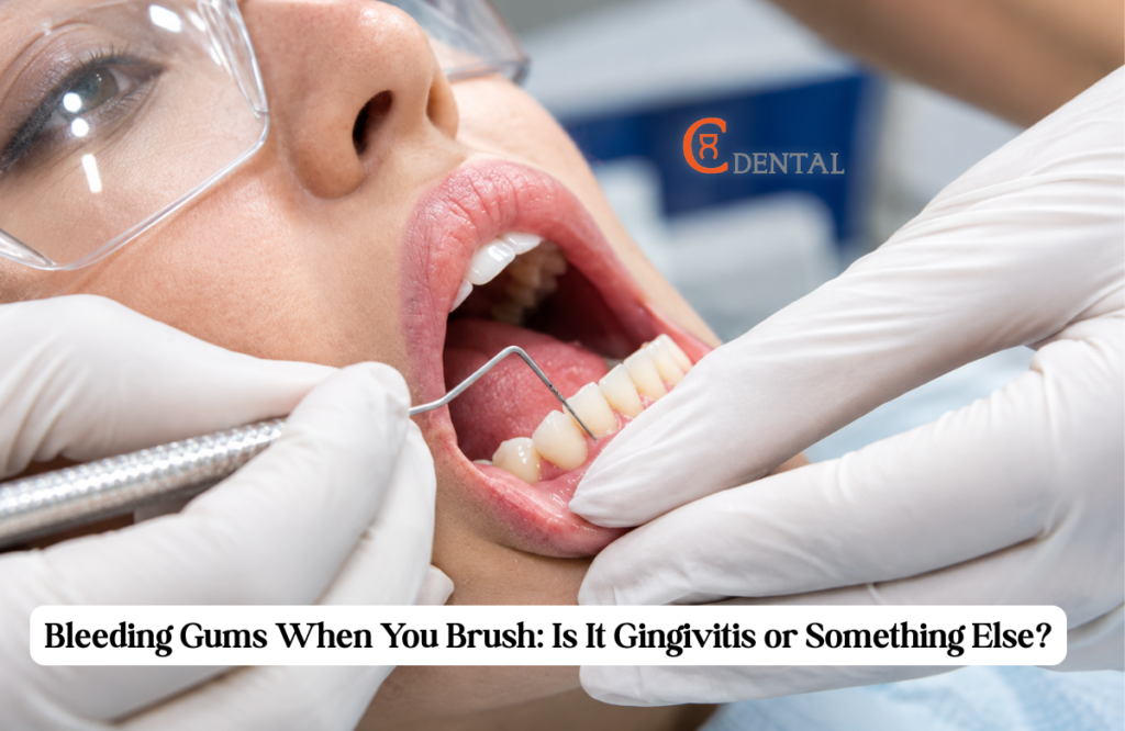 Dentist examining a patient's gums for signs of bleeding and gingivitis