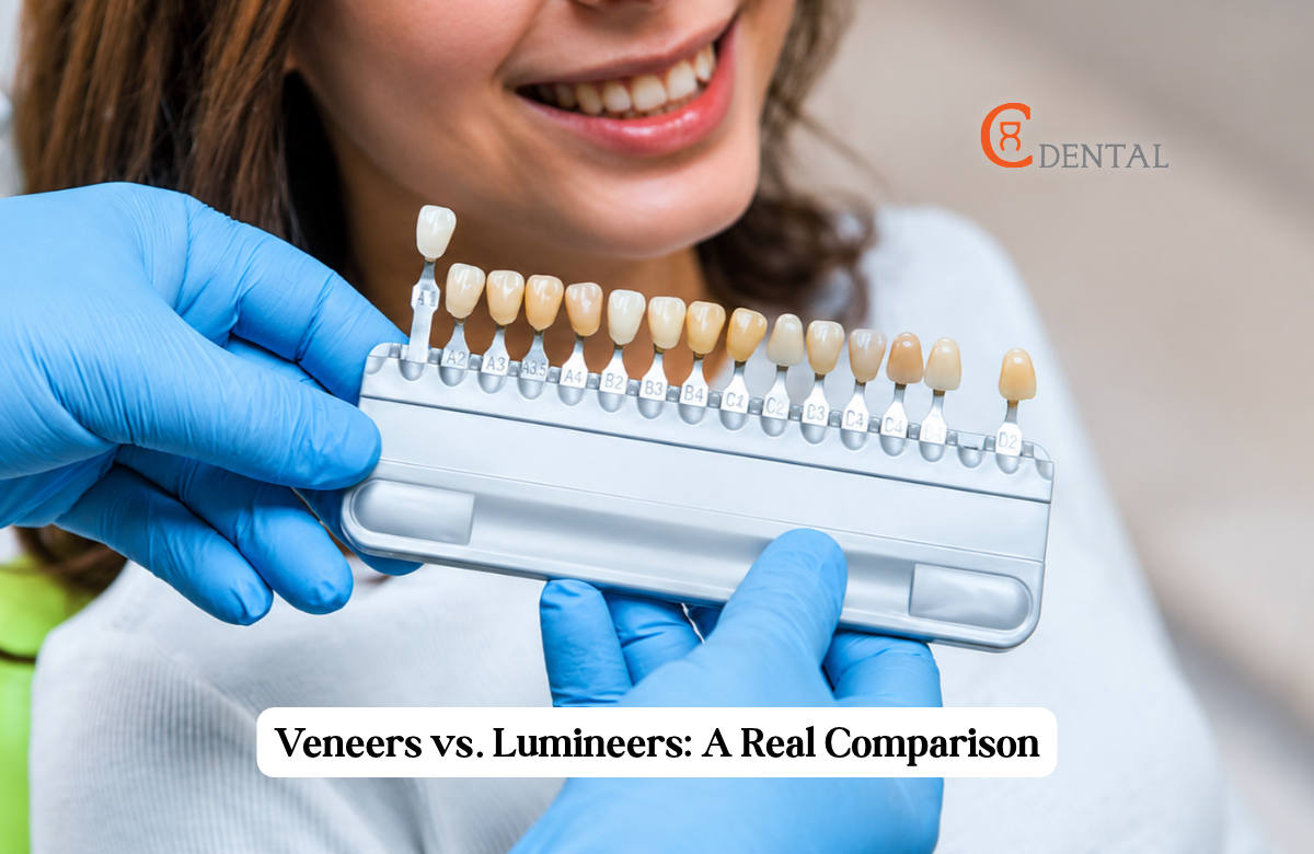 Dentist holding a dental shade guide to compare tooth colours for veneers and Lumineers.